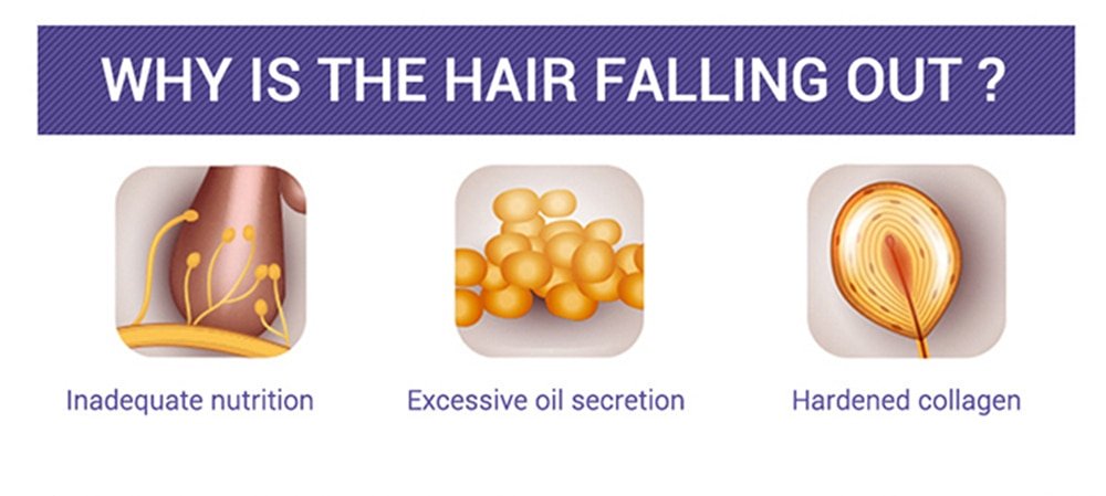 Hair Growth Essential Oils Serum